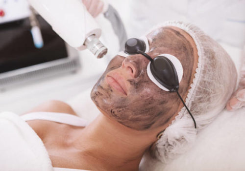 Close up of a mature woman wearing protective eyeglasses, getting carbon laser peel treatment by cosmetologist